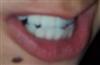 Cheese